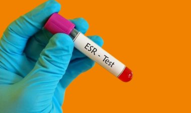 Well health tips in hindi wellhealthorganic : ESR Test क्या होता है?  टेस्ट क्यों कराया जाता है एवं ESR टेस्ट की सामान्य रेंज