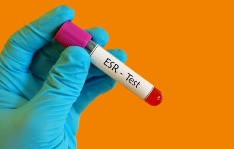 Well health tips in hindi wellhealthorganic : ESR Test क्या होता है?  टेस्ट क्यों कराया जाता है एवं ESR टेस्ट की सामान्य रेंज
