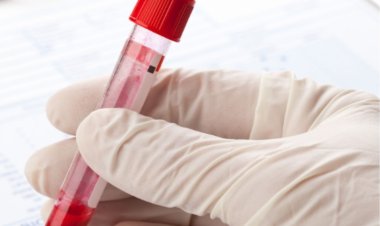 Cost of Blood Test in Ontario, Canada
