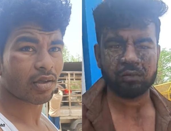 क्या.... जबलपुर में कानून से ऊपर रिकवरी एजेंसी? दो भाइयों पर हमला!